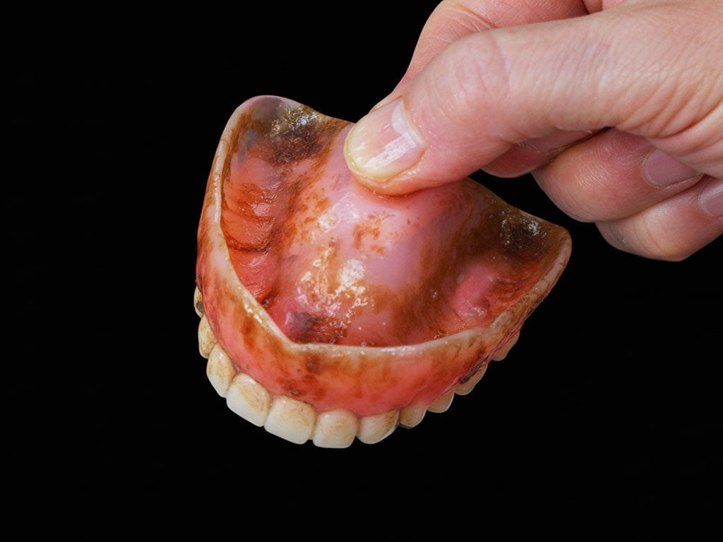 Denture before cleaning — stained